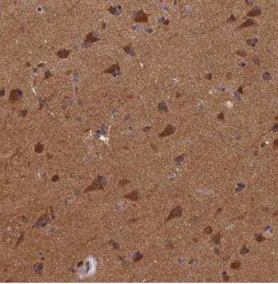 Immunohistochemistry-Paraffin: BICD1 Antibody [NBP1-85843]