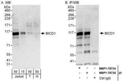 Western Blot: BICD1 Antibody [NBP1-78735]