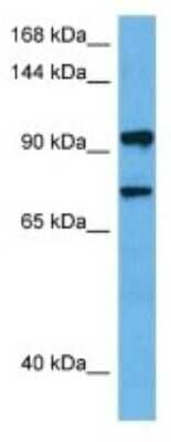 Western Blot: BICD1 Antibody [NBP3-10679]