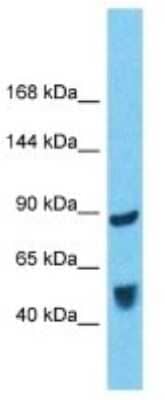 Western Blot: BICD1 Antibody [NBP3-10778]