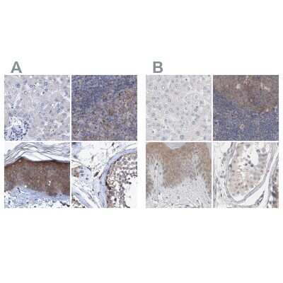 Immunohistochemistry-Paraffin: BICD2 Antibody [NBP1-81488]