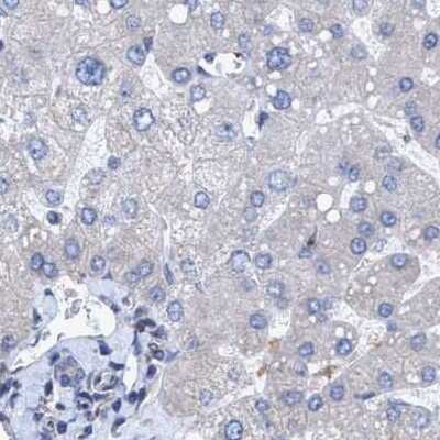 Immunohistochemistry-Paraffin: BICD2 Antibody [NBP1-81488]