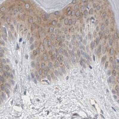 Immunohistochemistry-Paraffin: BICD2 Antibody [NBP1-81489]