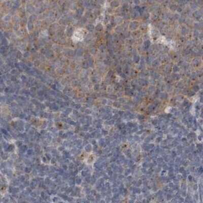 Immunohistochemistry-Paraffin: BICD2 Antibody [NBP1-81489]