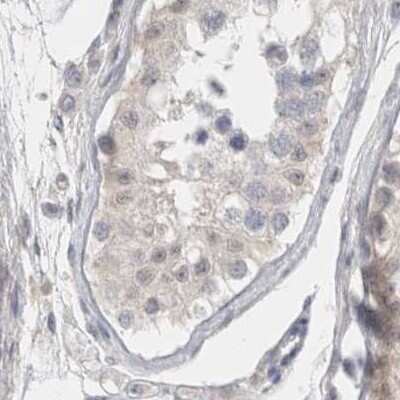 Immunohistochemistry-Paraffin: BICD2 Antibody [NBP1-81489]