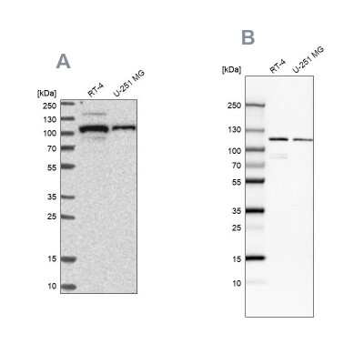 Western Blot: BICD2 Antibody [NBP1-81489]