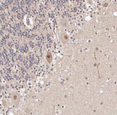 Immunohistochemistry-Paraffin: BICRAL Antibody [NBP1-86360]