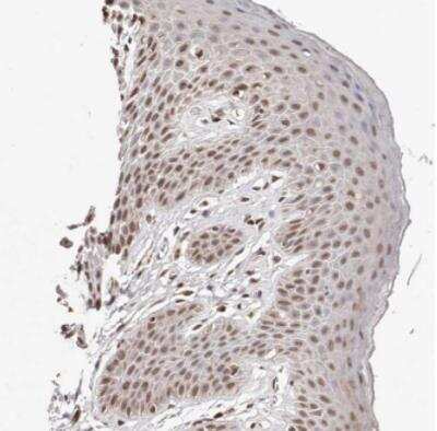 Immunohistochemistry-Paraffin: BICRAL Antibody [NBP1-86360]