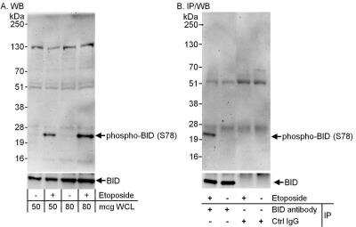 Western Blot: BID [p Ser78] Antibody [NB500-260]