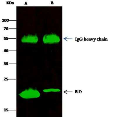 Immunoprecipitation: BID Antibody (002) [NBP2-89515]