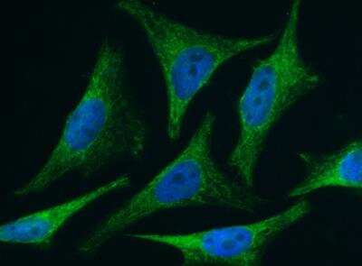 Immunocytochemistry/ Immunofluorescence: BID Antibody (005) [NBP2-89516]