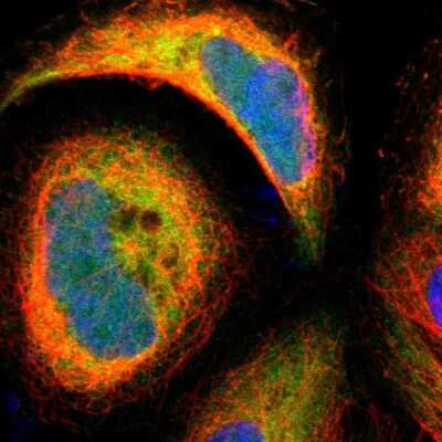 Immunocytochemistry/ Immunofluorescence: BID Antibody [NBP1-86187]