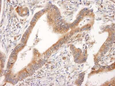 Immunohistochemistry-Paraffin: BID Antibody [NB500-245]