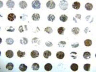 Immunohistochemistry-Paraffin: BID Antibody [NB100-56106]