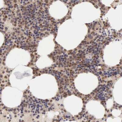 Immunohistochemistry-Paraffin: BID Antibody [NBP1-86187]