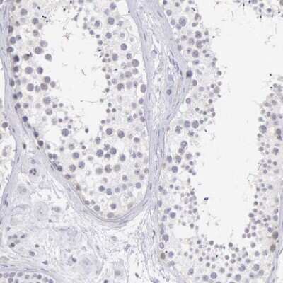 Immunohistochemistry-Paraffin: BID Antibody [NBP1-86187]