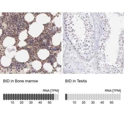 Immunohistochemistry-Paraffin: BID Antibody [NBP1-86187]