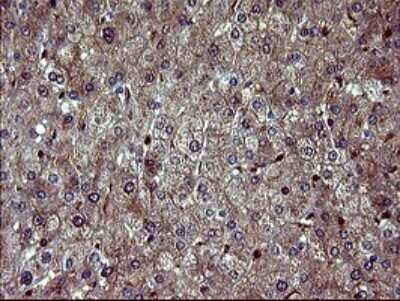 Immunohistochemistry: BID Antibody (OTI1G10) - Azide and BSA Free [NBP2-70254]