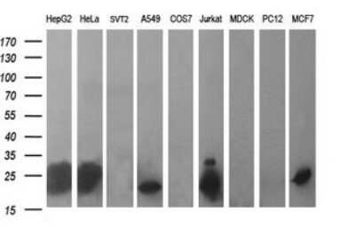 Western Blot: BID Antibody (OTI1G10)Azide and BSA Free [NBP2-70254]