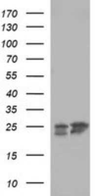 Western Blot: BID Antibody (OTI1G10)Azide and BSA Free [NBP2-70254]