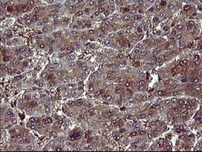 Immunohistochemistry: BID Antibody (OTI1G10) [NBP2-46575]