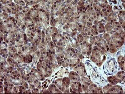 Immunohistochemistry: BID Antibody (OTI1G10) [NBP2-46575]