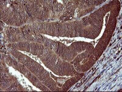 Immunohistochemistry: BID Antibody (OTI1G10) [NBP2-46575]