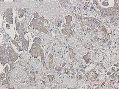 Immunohistochemistry-Paraffin: BID Antibody (S08-2F0) [NBP3-19838]
