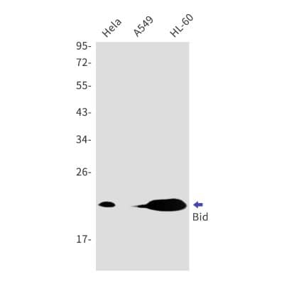 Western Blot: BID Antibody (S08-2F0) [NBP3-19838]