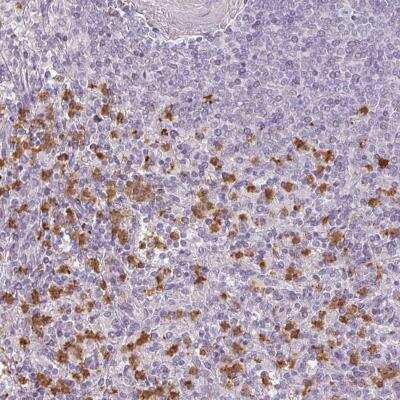 Immunohistochemistry-Paraffin: BIK Antibody [NBP2-33612]