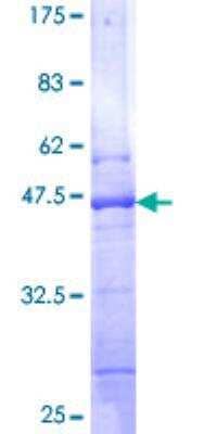 SDS-PAGE: Recombinant Human BIK GST (N-Term) Protein [H00000638-P01]