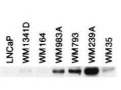 Western Blot: BIN1 Antibody (12A) [NBP2-21689]