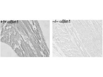 Immunohistochemistry-Paraffin: BIN1 Antibody (2F11) [NBP2-21675]