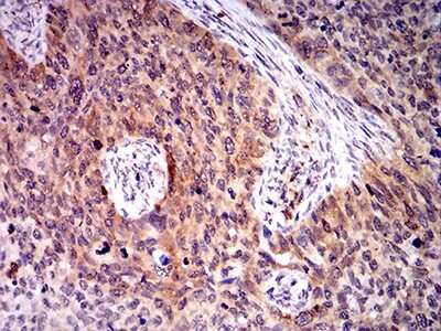 Immunohistochemistry: BIN1 Antibody (3B6F10) - BSA Free [NBP2-61714]