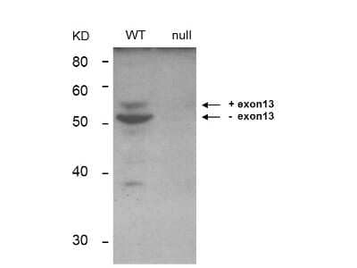 Western Blot: BIN1 Antibody (99D) [NBP2-21673]