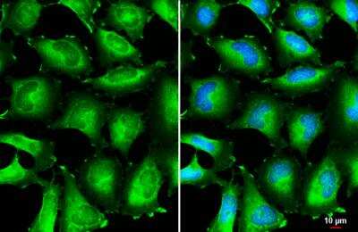 Immunocytochemistry/ Immunofluorescence: BIN1 Antibody [NBP2-15587]