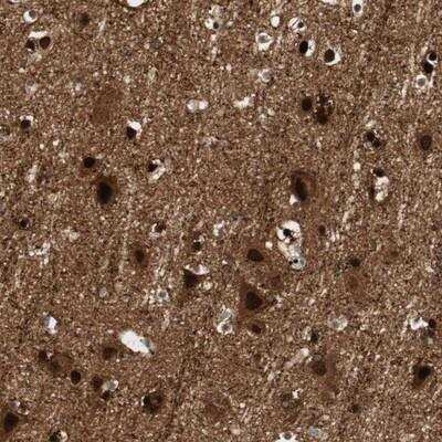 Immunohistochemistry: BIN1 Antibody [NBP1-89103]