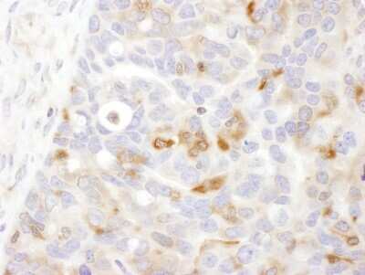 Immunohistochemistry-Paraffin: BIN1 Antibody [NBP1-46170]