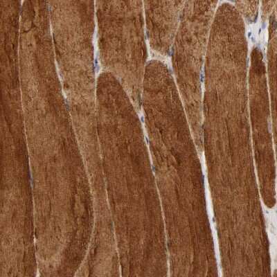 Immunohistochemistry-Paraffin: BIN1 Antibody [NBP1-89102]