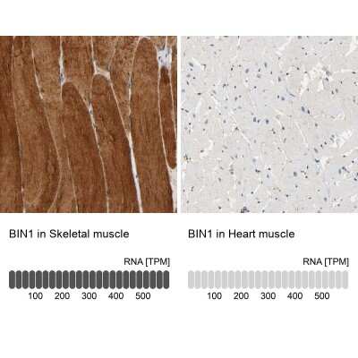 Immunohistochemistry-Paraffin: BIN1 Antibody [NBP1-89102]