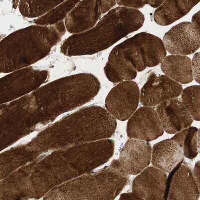 Immunohistochemistry-Paraffin: BIN1 Antibody [NBP1-89103]