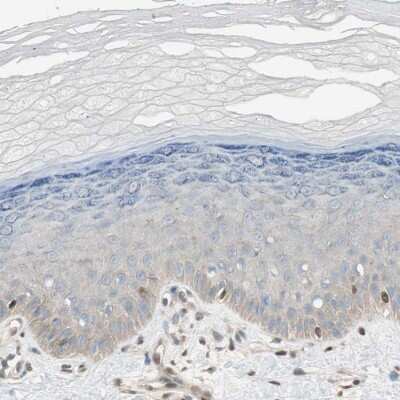 Immunohistochemistry-Paraffin: BIN1 Antibody [NBP1-89103]