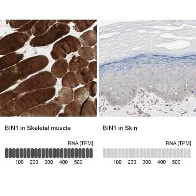 Immunohistochemistry-Paraffin: BIN1 Antibody [NBP1-89103]