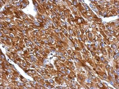Immunohistochemistry-Paraffin: BIN1 Antibody [NBP2-15587]