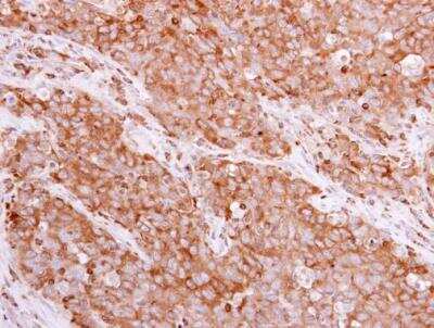Immunohistochemistry-Paraffin: BIN1 Antibody [NBP2-15587]