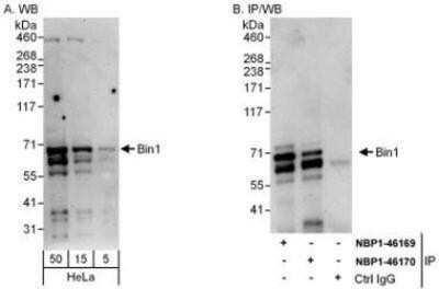 Western Blot: BIN1 Antibody [NBP1-46170]