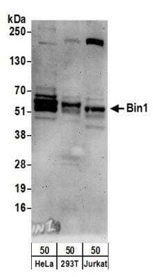 Western Blot: BIN1 Antibody [NBP1-46170]