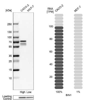 Western Blot: BIN1 Antibody [NBP1-89102]