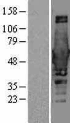 Western Blot: BIN1 Overexpression Lysate [NBP2-04422]