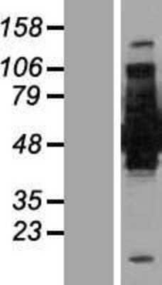 Western Blot: BIN1 Overexpression Lysate [NBP2-05567]